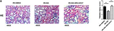 Corrigendum: Butyric acid protects against renal ischemia–reperfusion injury by adjusting the Treg/Th17 balance via HO-1/p-STAT3 signaling